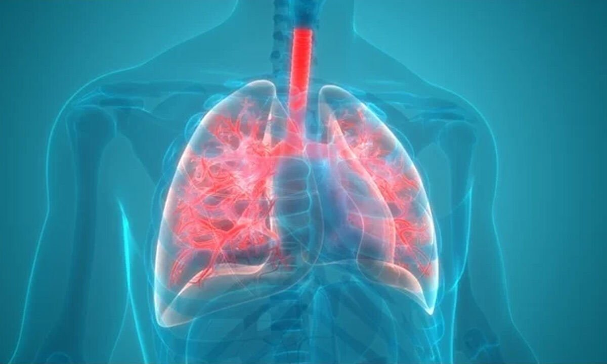 Rising Cases of Pneumonia in Hyderabad as Winter Takes Hold Doctors Emphasize 'Kangaroo Care' for Prevention